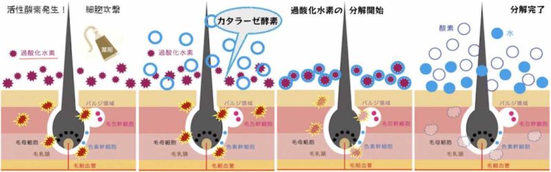 髪#142【ヘアカラー11】薬剤を無かったことに!