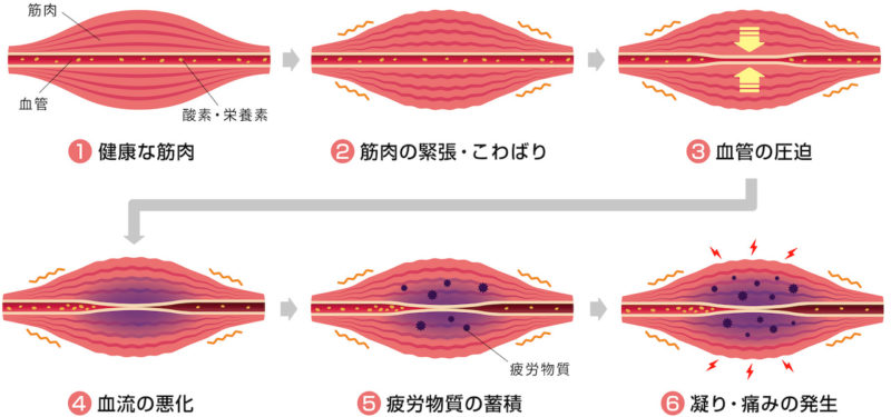 筋肉老化がキレイになれない原因?“コリ”を放置しないこと!【体#02】